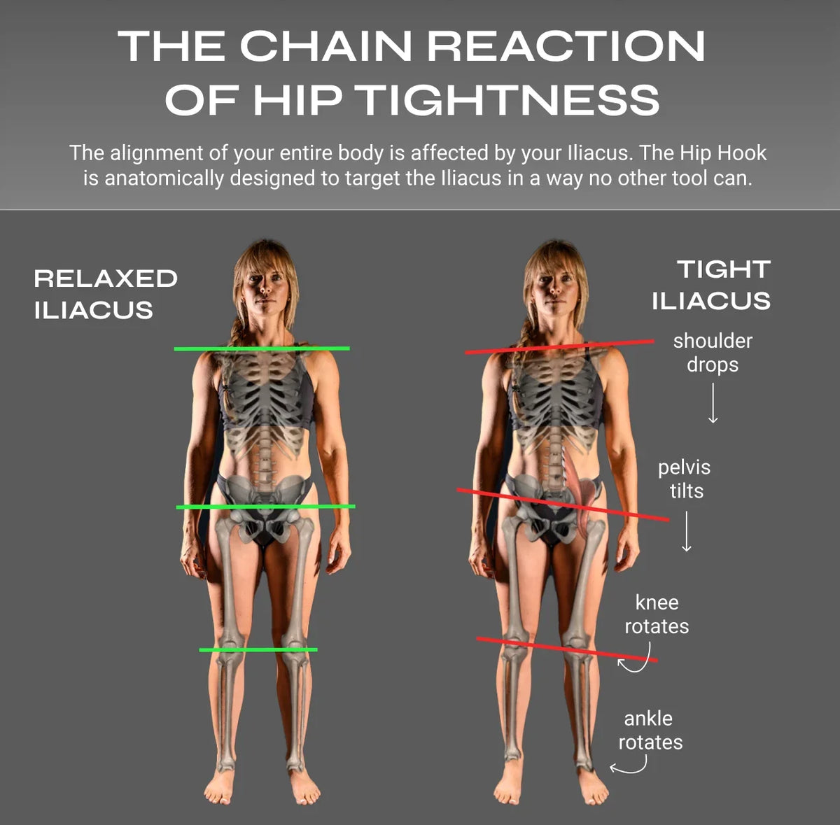 Deep Hip Flexor Massage System
